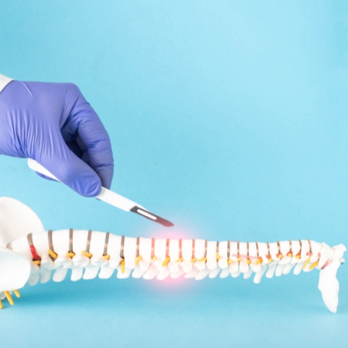 Minimal Access Spine Surgery